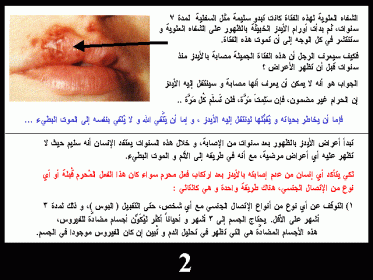 مرض الايدز واعراضه بالصور